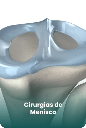 c-menisco